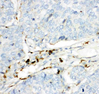 Anti-HEXB Antibody