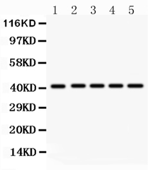 Anti-HOXA10 Antibody