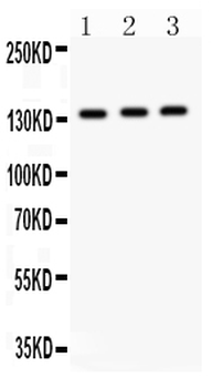 Anti-IRS1 Antibody