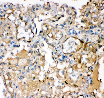 Anti-Maxi Potassium channel alpha/KCNMA1 Antibody