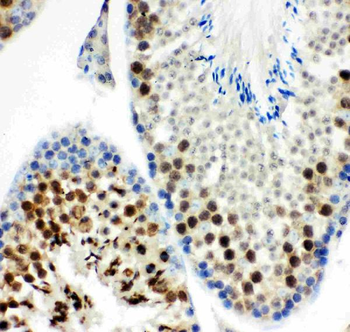 Anti-MCAK/KIF2C Antibody