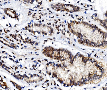 Anti-Glucocorticoid Receptor/NR3C1 Antibody