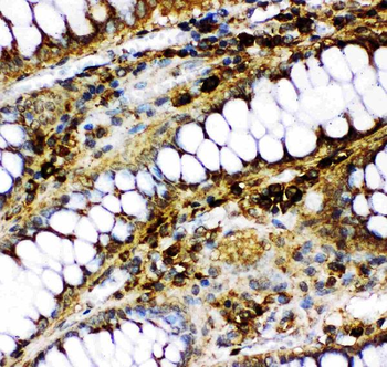 Anti-p73/TP73 Antibody