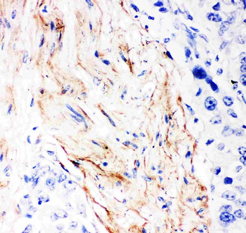 Anti-Decorin/DCN Antibody