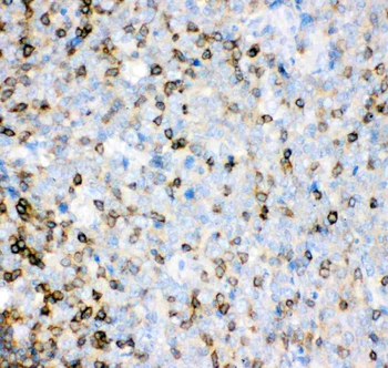 Anti-IL16 Antibody