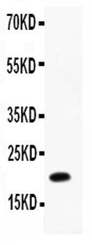 Anti-IL12 p40/IL12B Antibody