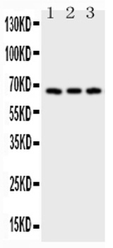 Anti-CD30/TNFRSF8 Antibody