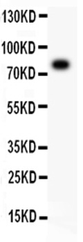 5 Lipoxygenase/ALOX5 Antibody