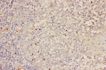 Anti-Forkhead box protein P3 FOXP3 Antibody