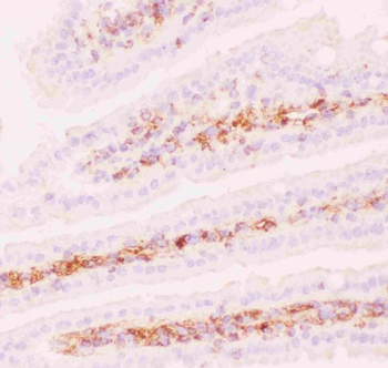 Anti-P Glycoprotein/ABCB1 Antibody