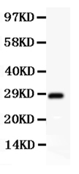 Anti-SCP3/SYCP3 Antibody