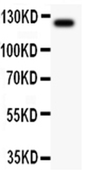 Anti-TIE2/TEK Antibody