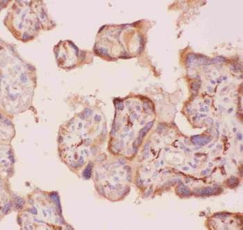 Anti-Angiopoietin 2/ANGPT2 Antibody