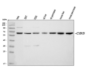 Cystathionine beta-synthase CBS Antibody