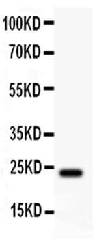 Anti-Claudin 5/CLDN5 Antibody