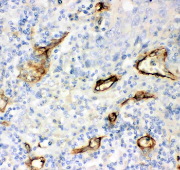 Anti-CD146/MCAM Antibody