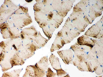 Anti-SERCA1 ATPase/ATP2A1 Antibody