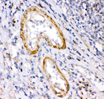 Anti-Calretinin/CALB2 Antibody