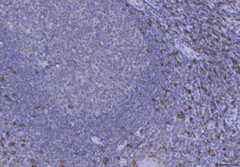 Anti-CD8 alpha/CD8A Antibody