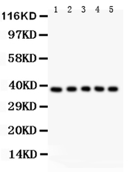 Anti-Fas Antibody