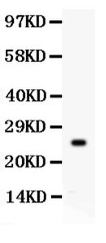 Kallikrein 4/KLK4 Antibody