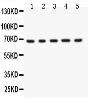 Anti-Menin/MEN1 Antibody