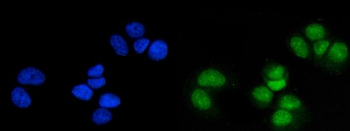 Anti-MSK1/RPS6KA5 Antibody