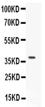 LKB1/STK11 Antibody