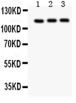 Anti-TRPC5 Antibody