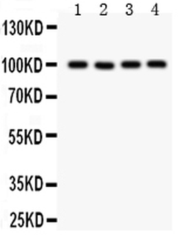 Anti-TRP 7/TRPC7 Antibody
