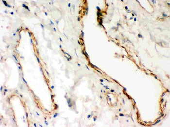 Anti-Dystrophin/DMD Antibody