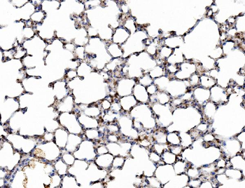 Anti-Galectin 3/LGALS3 Antibody