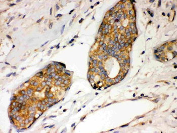 Anti-IKB alpha/NFKBIA Antibody