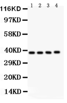Anti-IKB beta/NFKBIB Antibody