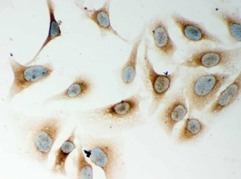 Anti-CARD4/NOD1 Antibody