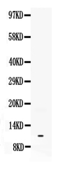 Anti-Neuropeptide Y/NPY Antibody