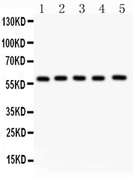 NR5A2/LRH1 Antibody