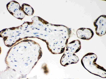 Anti-PAPP A/PAPPA Antibody