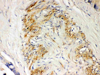 Anti-Parkin/PRKN Antibody