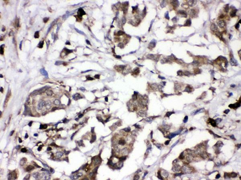 Anti-PKC alpha/PRKCA Antibody