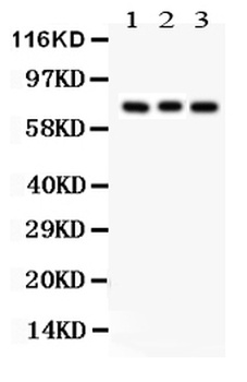 PKC beta 1/PRKCB Antibody