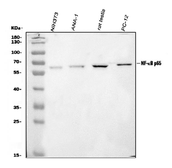 Anti-NF-kB p65/RELA Antibody