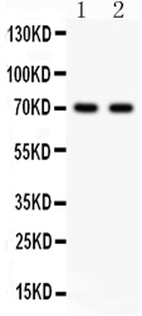 Anti-Sex Hormone Binding Globulin/SHBG Antibody