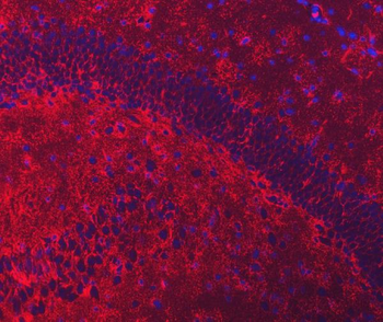 Anti-EAAT2/GLT-1/SLC1A2 Antibody
