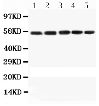 Anti-Caspase-8/CASP8 Antibody