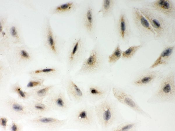 Anti-LYRIC/MTDH Antibody