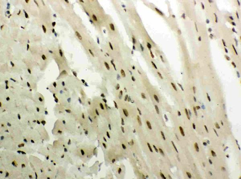 Anti-Glucocorticoid Receptor/NR3C1 Antibody