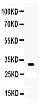 Anti-Otx2 Antibody
