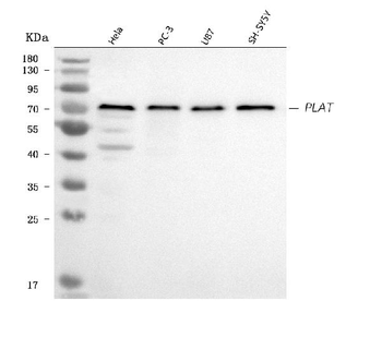 Anti-TPA Tissue Plasminogen Activator/PLAT Antibody