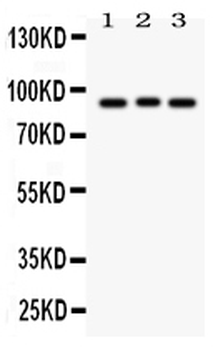 Anti-Semaphorin 3A/SEMA3A Antibody